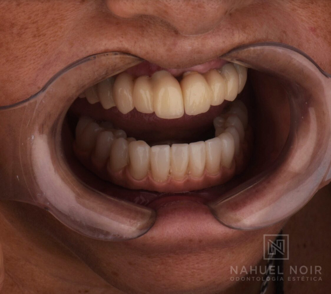 Noir Nahuel Odontólogo